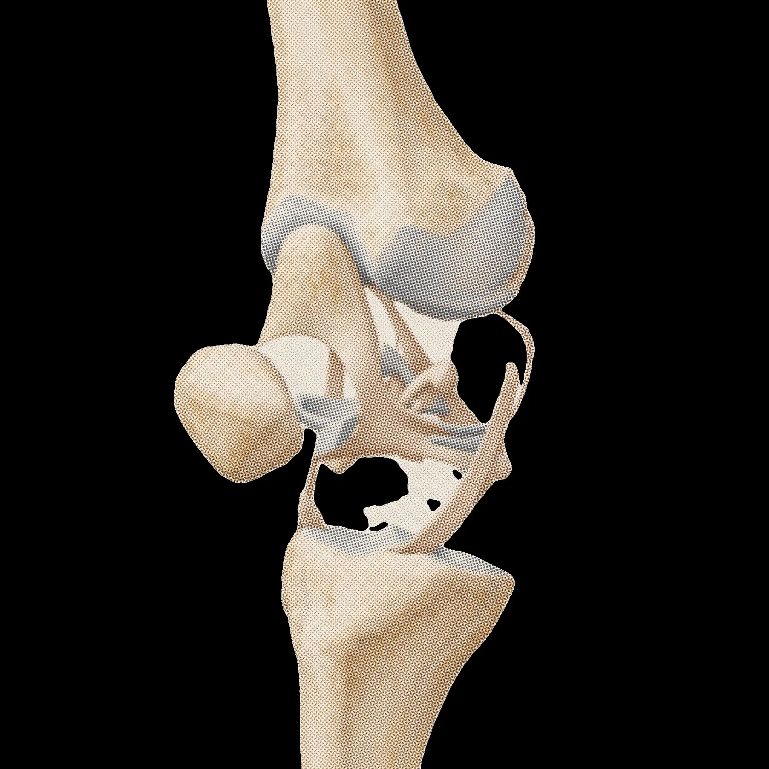 The knee joint, with cartilage and cruciate ligaments